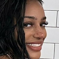 Freckles Nagie