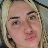 ninfacarnicera Nagie