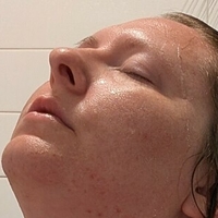 titlaser Nagie