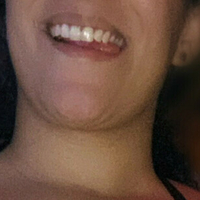 zoracensored Nagie